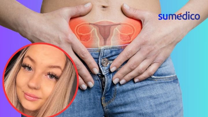 'Creí que mi inflamación abdominal fue por una caída, pero era cáncer de ovario'