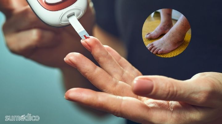 ¿Qué síntomas da la diabetes? 10 señales que NO debes ignorar