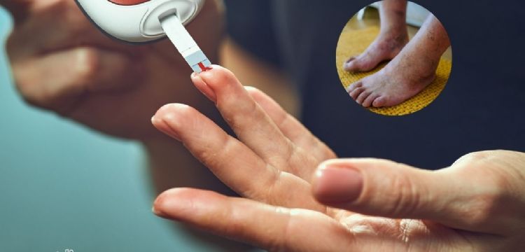¿Qué síntomas da la diabetes? 10 señales que NO debes ignorar