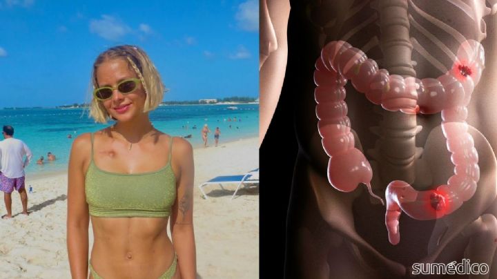 Bailey Hutchins, estrella de TikTok, murió de cáncer a los 26; estos fueron sus primeros síntomas