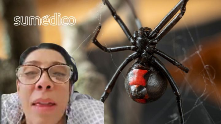 ¿Qué hacer si me pica una viuda negra como a Cynthia Klitbo?