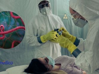 Ébola: los síntomas “raros” que alertan a México