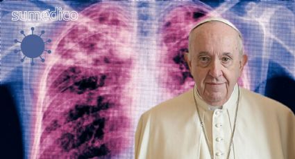 ¿Qué es la neumonía bilateral que le detectaron al Papa Francisco?