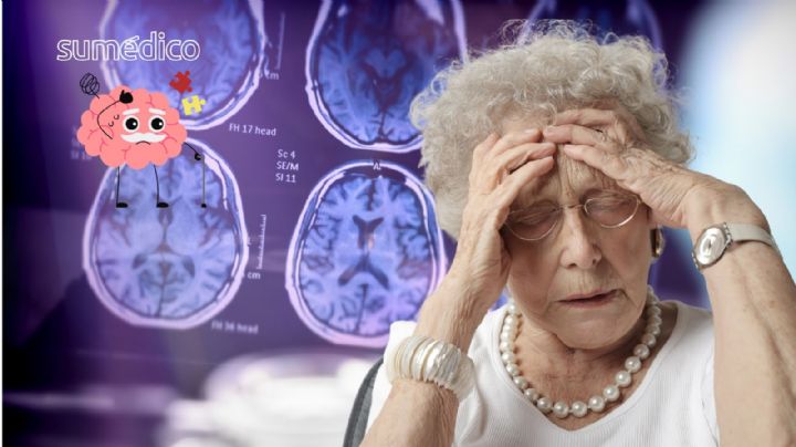 El ejercicio que previene el Alzheimer y reduce la inflamación cerebral