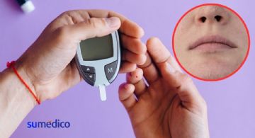 ¿Cómo se ponen los labios cuando tienes glucosa alta?