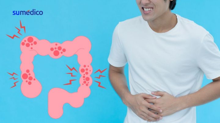¿Quieres evitar el cáncer de colon? Este es el alimento que debes comer
