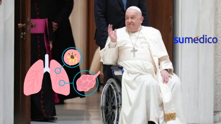 El Vaticano informa que la salud del Papa es crítica, ¿qué tiene?