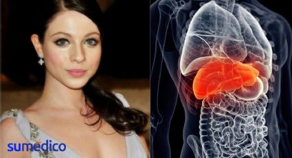 ¿En qué consiste el trasplante de hígado tras el que falleció Michelle Trachtenberg?