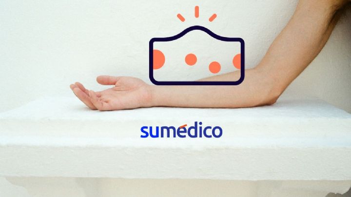 5 razones por las que te puede salir una bolita en el brazo