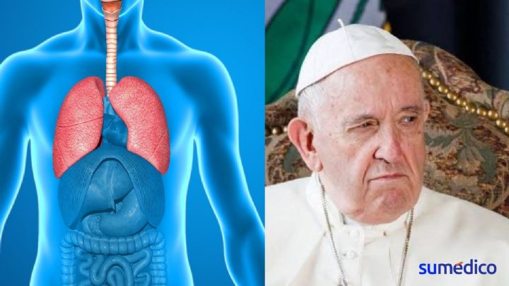 ¿Qué es el broncoespasmo que empeoró la salud del Papa Francisco?