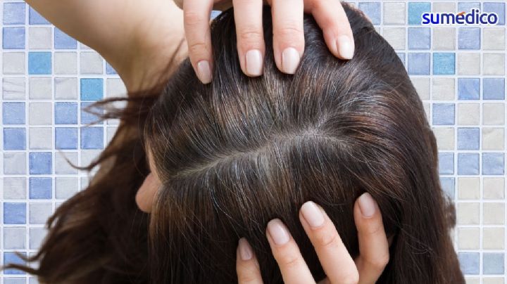 ¿Qué significa tener canas a una edad temprana?