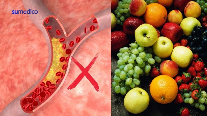 ¿Cómo limpiar las arterias? Comer esta fruta te ayudará