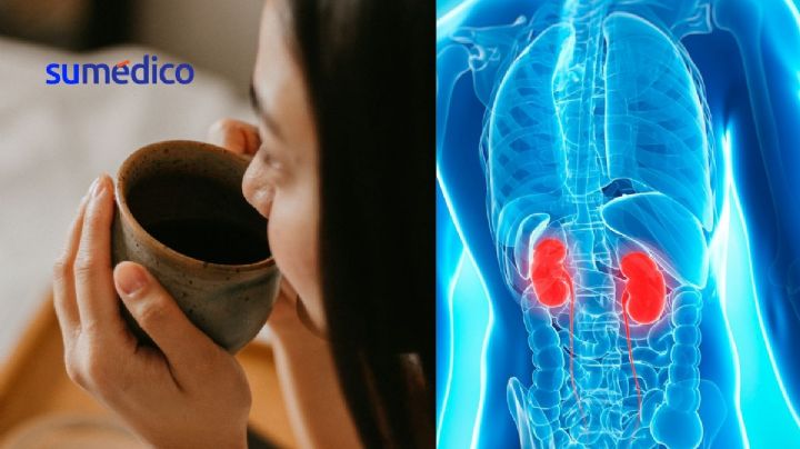 ¿Qué le pasa a los riñones si tomas café todos los días?