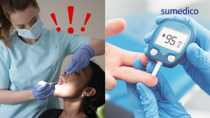 La infección de la boca que es más común en la diabetes