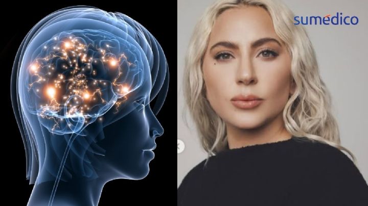 ¿Qué es la psicosis que llegó a padecer Lady Gaga? Estos fueron sus síntomas