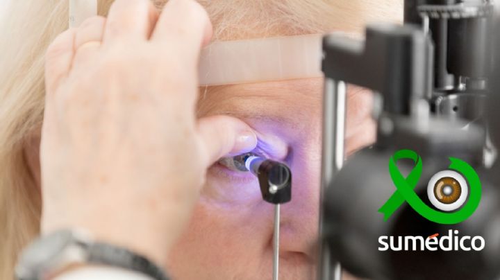 ¿Qué síntomas da el glaucoma? 5 señales que NO debes ignorar