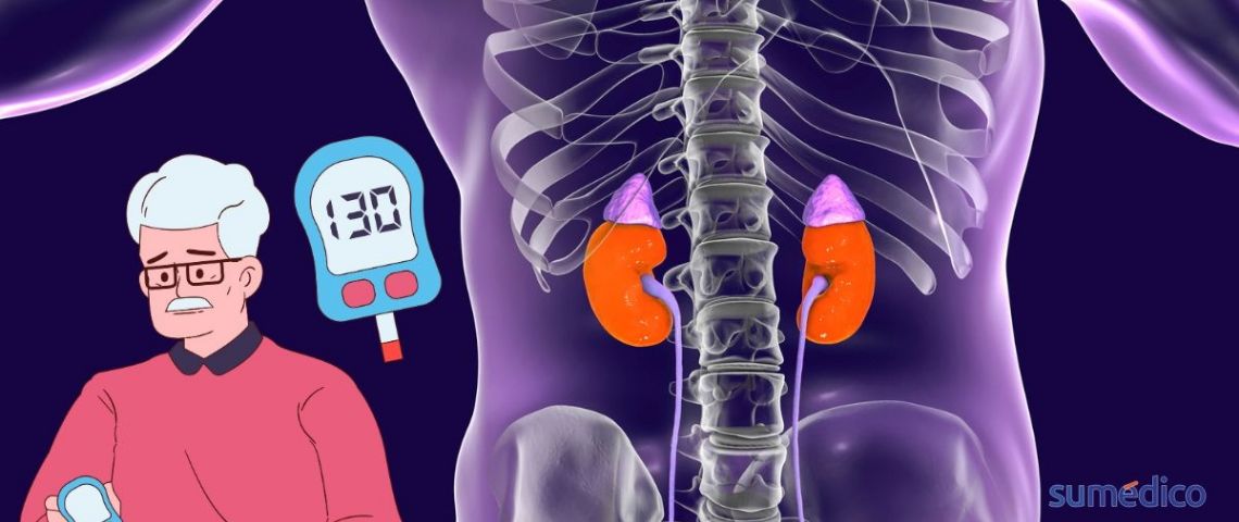 ¿Qué efecto tiene en los riñones la diabetes? 6 síntomas de un daño irreversible