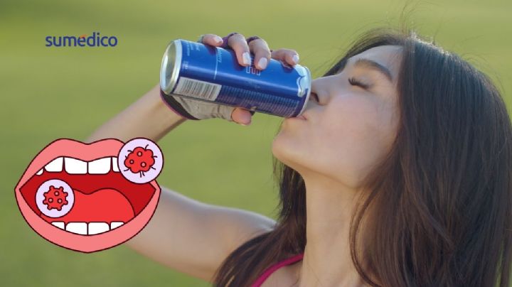 ¿Tomar refresco puede provocar cáncer oral en mujeres?