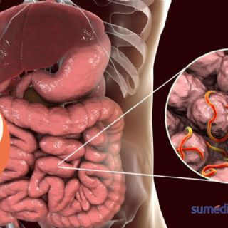 La fruta de temporada que debes consumir para eliminar los parásitos intestinales