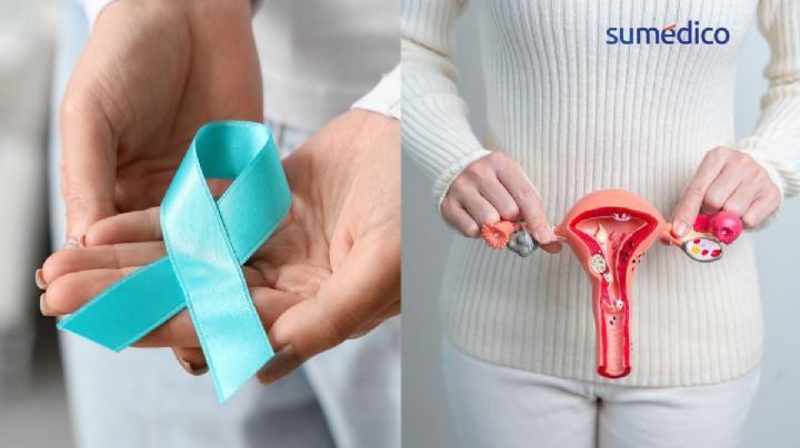 'El cáncer cervicouterino es prevenible en un 99%': Oncóloga explica cómo