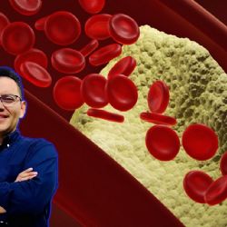 Señales de que estás en riesgo de colesterol y triglicéridos altos, según un endocrinólogo