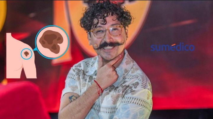 Mau Nieto anuncia que tiene cáncer, ¿de qué se trata?