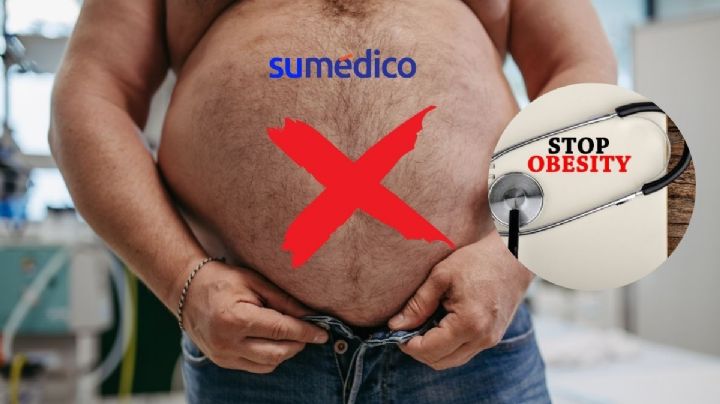 5 consejos para prevenir la obesidad