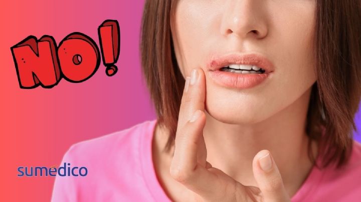 ¿Haces esto cuando tienes un fuego labial? Podría empeorar la infección