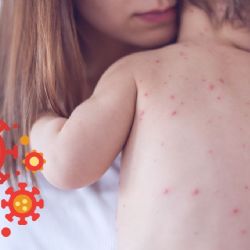¿Qué síntomas da el sarampión y qué hacer si mi hijo lo tiene?