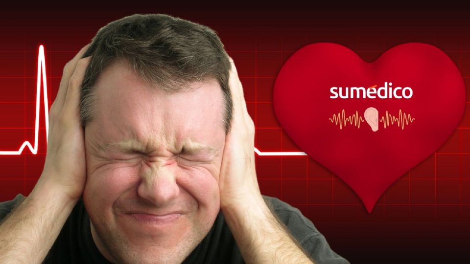 El  acúfeno pulsátil, una variante del tinnitus, puede presentarse de forma esporádica.