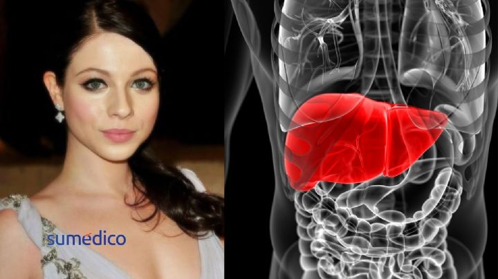 ¿De qué murió Michelle Trachtenberg? Revelan la grave enfermedad que padeció