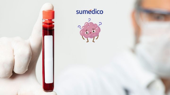 Detectar alzhéimer con una muestra de sangre ya es posible