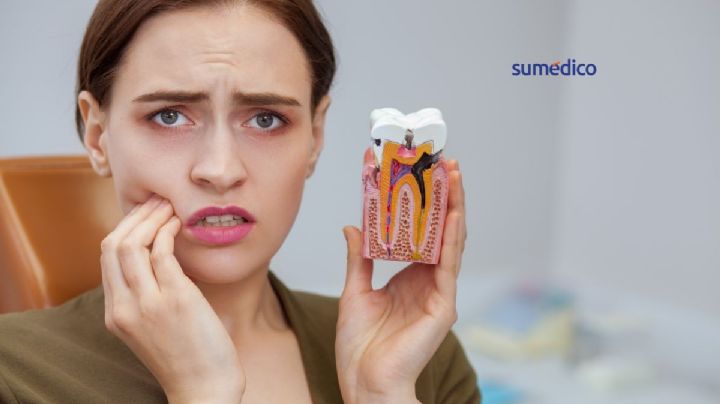 ¿Cómo afecta a la salud en general tener caries?