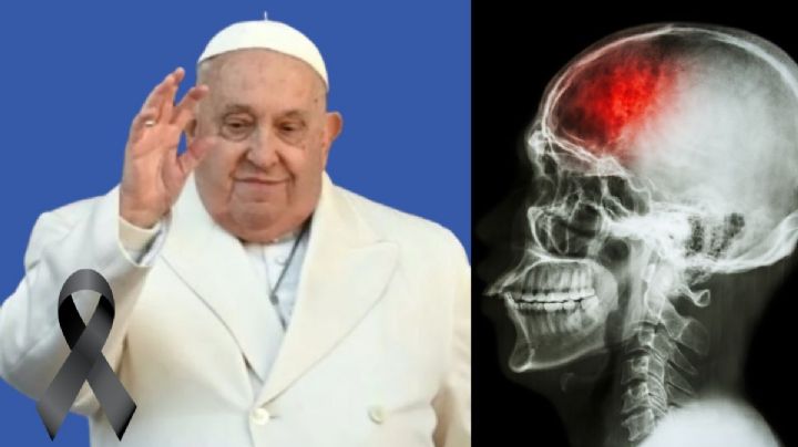 ¿Qué causa un derrame, motivo confirmado de la muerte del Papa Francisco?