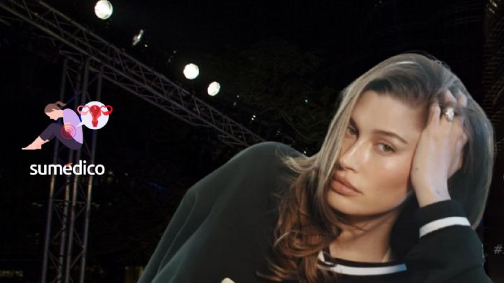 ¿Qué tan grave es tener quistes ováricos como los que tiene Hailey Bieber?
