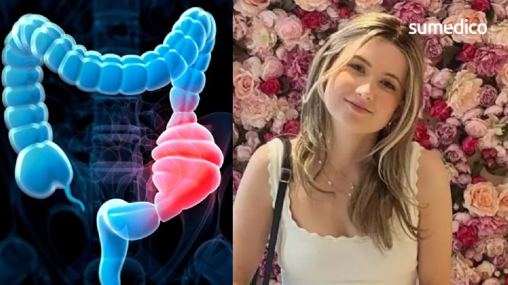 Dominique McShain: ¿Qué causa un cáncer de colon a los 21 años como el que padeció?