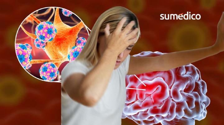¿Qué es la meningitis y qué síntomas da? 5 señales que NO debes ignorar