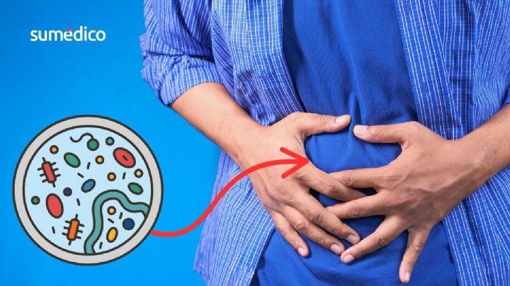 ¿Tuviste esta infección en la infancia? Podrías tener más riesgo de cáncer de colon precoz