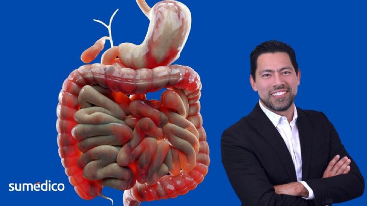 ¿Diarrea frecuente? Experto revela qué enfermedad podrías tener