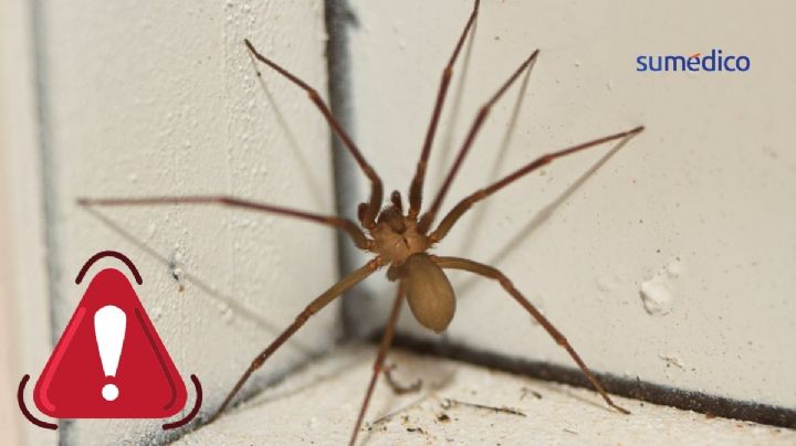 ¿Cómo reconocer una mordedura de araña violinista y qué hacer?
