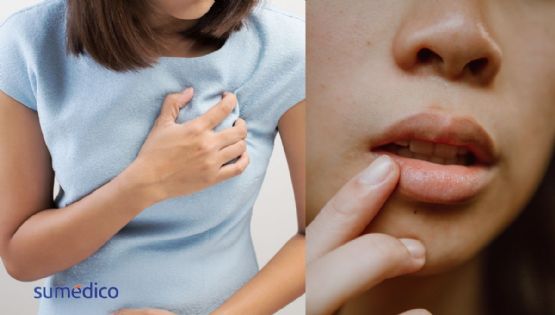 El síntoma en los labios que podría alertar una enfermedad cardiaca