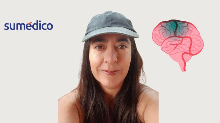 'Mi mamá no podía mover su brazo ni hablar; era una trombosis cerebral'
