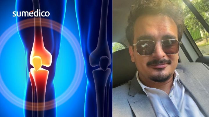 ¿Qué causa problemas de rodilla como el que padece el comediante Ricardo Pérez?