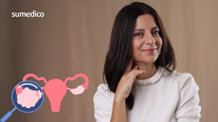 'Pensé que me dolía el apéndice, en realidad tenía cáncer de ovario'