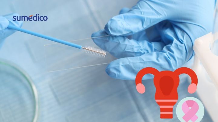 ¿Adiós al Papanicolaou? Aprueban primer prueba casera para detectar VPH