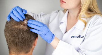 ¿Adiós a la alopecia? Un experimento consiguió resultados prometedores
