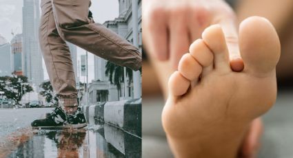 Lluvias: Estas infecciones puedes tener en los pies si pisas un charco