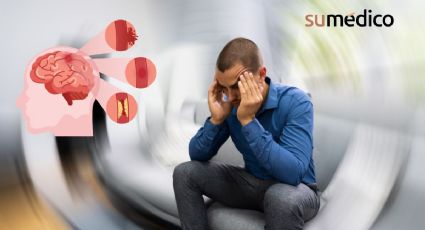 Derrame cerebral: Estas son las señales que no debes ignorar