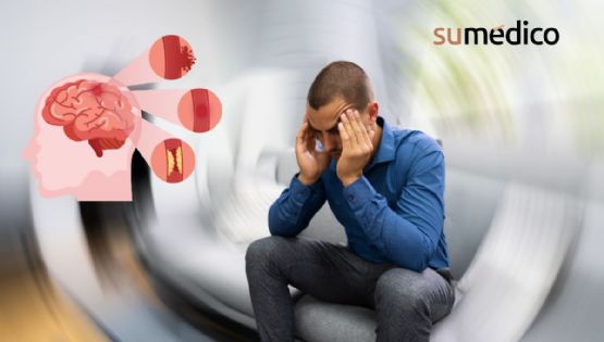 Derrame cerebral: Estas son las señales que no debes ignorar