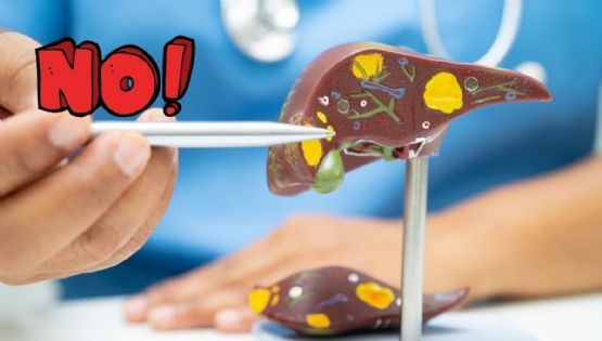 5 medidas MÁS efectivas para evitar el hígado graso